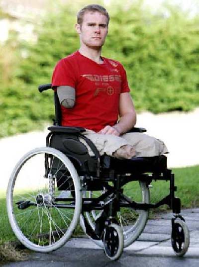 เผยชีวิต มาร์ค หนุ่มพิการแขนขาที่โชคดีที่สุดในโลก