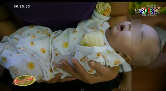 พบทารกหญิงวัย 3 เดือน หน้าตาน่ารักน่าชัง ถูกวางทิ้งใส่ตะกร้า 