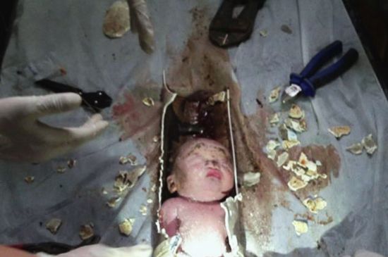 ทารกจีนถูกทิ้งลงท่อระบายน้ำ
