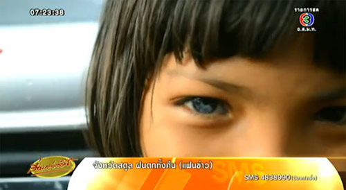 เด็กตาเพชร แพทย์แนะพาไปตรวจ คาดเกิดจากพันธุกรรม