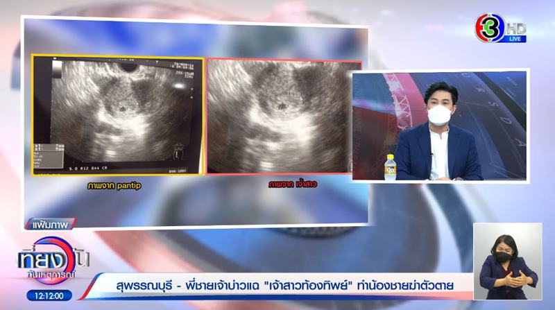 เจ้าบ่าวยิงตัวตายวันแต่งงาน เจ้าบ่าวยิงตัวตายวันแต่งงาน