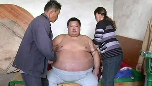 หนุ่มจีนป่วยประหลาด! น้ำหนักพุ่ง 30 กก. ในเวลา 19 วัน