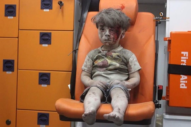 เด็กชาย 5 ขวบบาดเจ็บ-แววตาใสซื่อ ภาพสะท้อนเหยื่อบริสุทธิ์แห่งสงครามซีเรีย