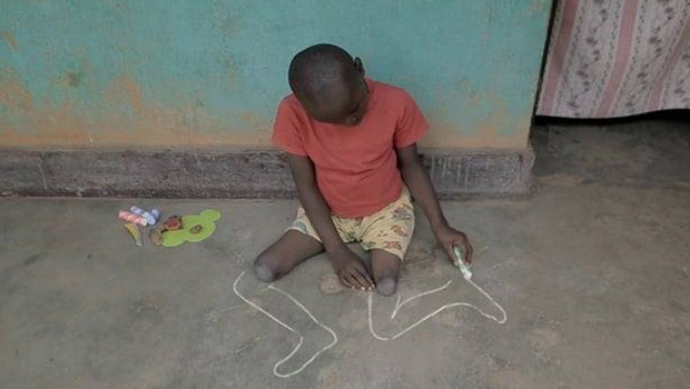 เด็กพิการขาวาดรูปขาให้ตัวเอง