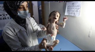 ขาดสารอาหาร