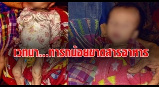 ขาดสารอาหาร