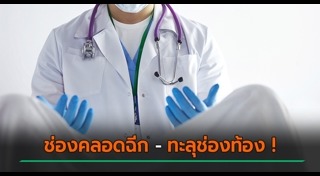 ช่องคลอด