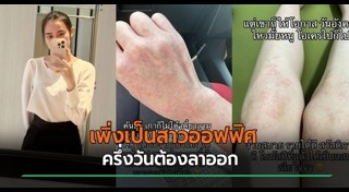 ผื่นคัน