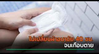 ผ้าอนามัย