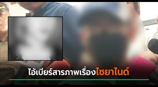 ไซยาไนด์