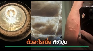 ผื่นคัน