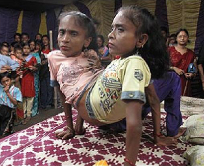 แฝดแมงมุม