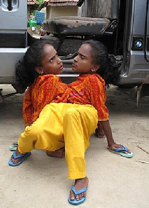 แฝดแมงมุม