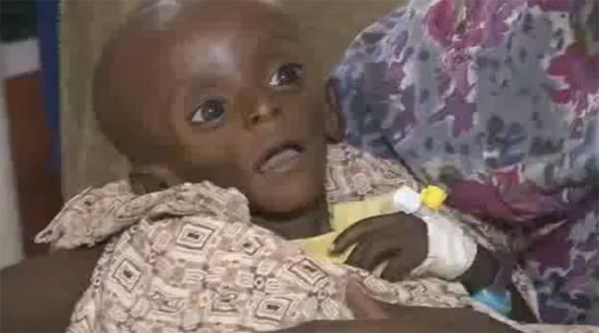 เผยภาพสุดสลด เด็กน้อยผอมโกรกใกล้ตายในเคนย่า