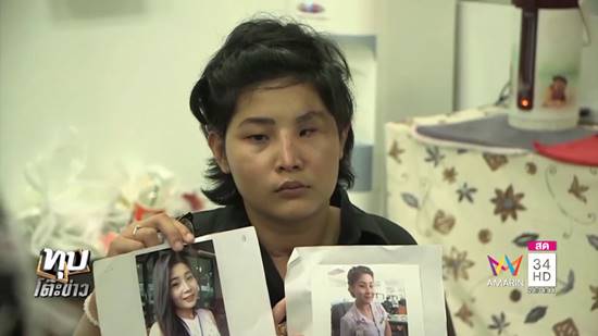 แม่น้องจูน วอนช่วยรักษาใบหน้าลูก ถูกหมวดแบงค์ทำร้าย กระดูกแตกทั้งหน้า