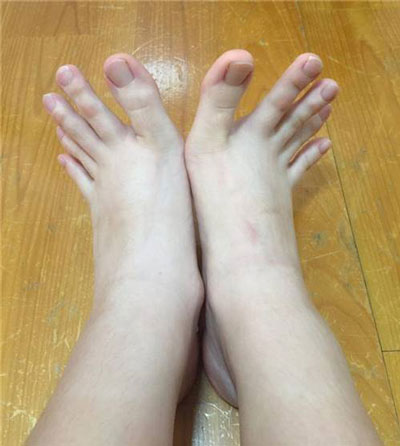 นิ้วเท้ายาวเหมือนนิ้วมือ
