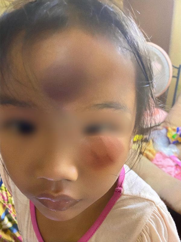 ลูกโดนทำร้าย
