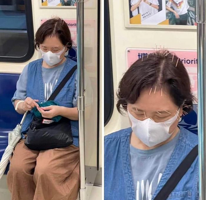 คนอึ้งป้าขึ้นรถไฟฟ้า เข็มเต็มหัวกว่า 30 เล่ม