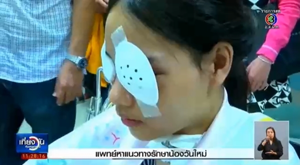 เหยื่อยิงผิดตัว