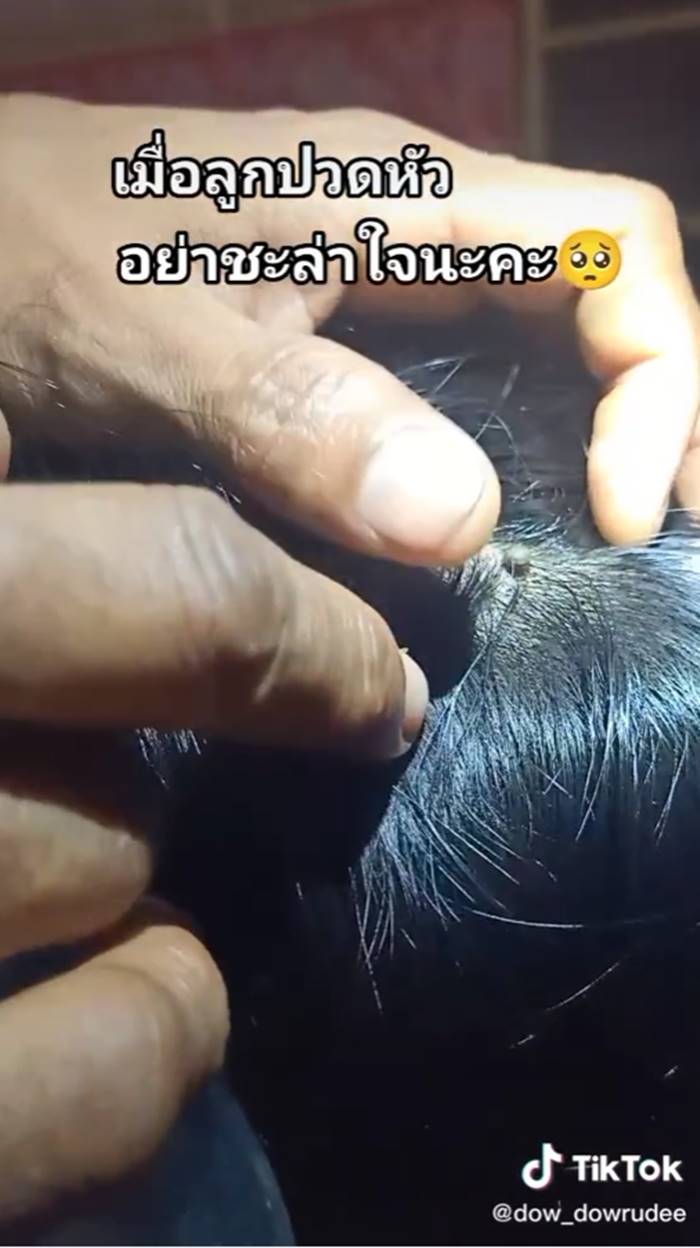 เห็บ