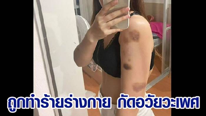 ทำร้ายร่างกายผู้หญิง