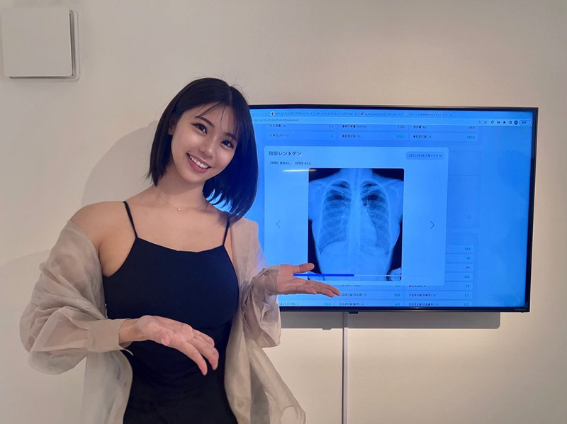 นางแบบสาวฮอต เปิดภาพเอกซเรย์