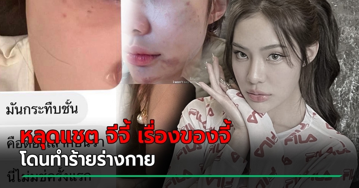 หลุดแชต จีจี้ สุพิชชา เจ้าของเพจ เรื่องของจี้ โดนทำร้ายร่างกาย น่วมหนัก