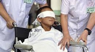 ควักลูกตา