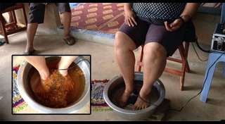 ดีท็อกซ์ลำไส้