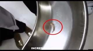 หนอนในตา