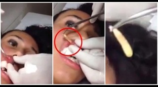 เชื้อราบนหนังศีรษะ