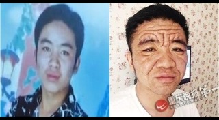 โรคทางพันธุกรรม