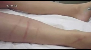 แมงกะพรุนกล่อง