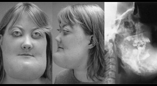 หน้าบวม