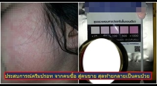 ครีมบำรุงรอบดวงตา