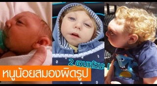 โรคสมองพิการ