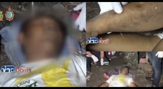 แมงมุมกัด