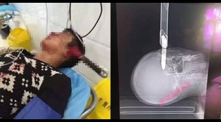 นักข่าวถูกทำร้าย