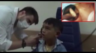 หนอนในหู