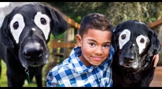 โรคด่างขาว