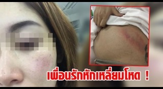 ทำร้ายคนท้อง