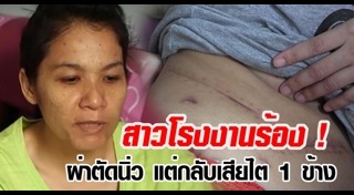 ผ่าตัดนิ่ว