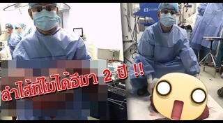 ลำไส้อักเสบ