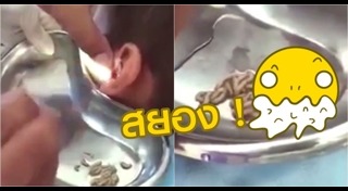 หนอนในหู