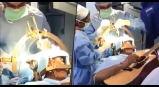 ผ่าตัดสมอง