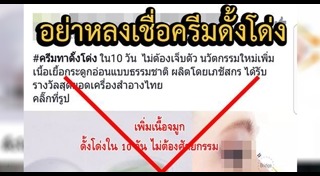 ขายครีม