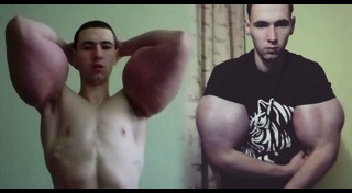 ศัลยกรรมชาย