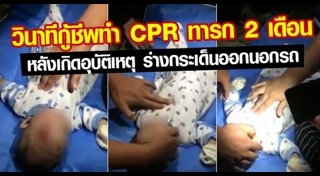 วิธีทำ cpr