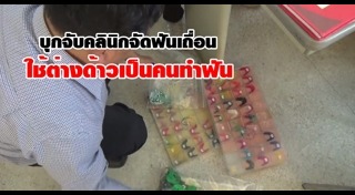 จัดฟันเถื่อน
