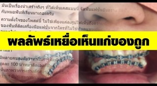 จัดฟันเถื่อน